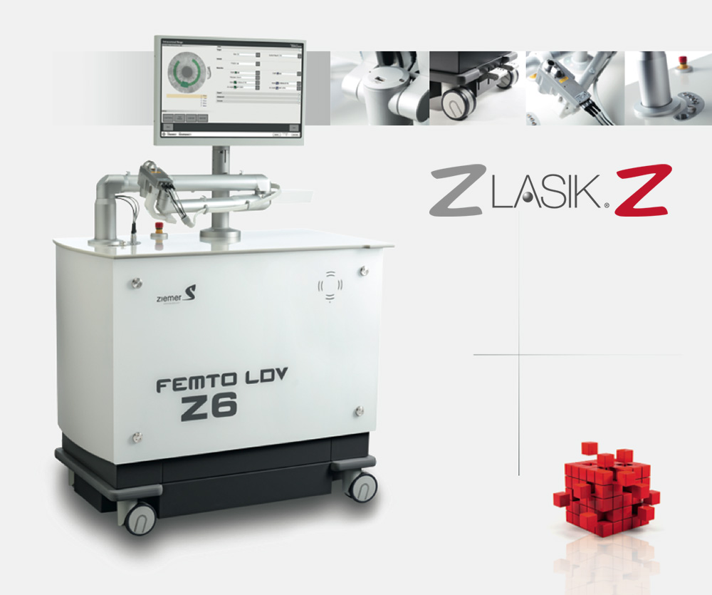 femtosecond laser and Z Lasik Z method