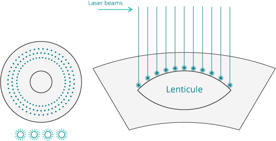 Other methods